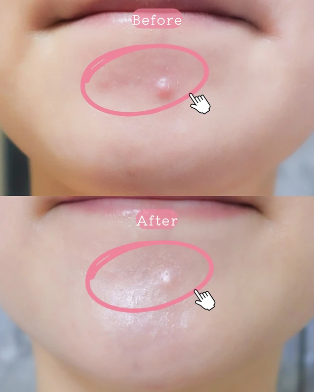 muice / ミュアイス クマメンテパウダー 02 / 青クマ・赤ニキビを自然にカバーできるパウダーコンシーラー