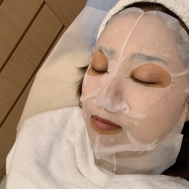 【ご当地美容】上海のヨセミテクリニックでM22(IPL治療)を受けてみた！6回コースでシミそばかすに効果あり！_2_1