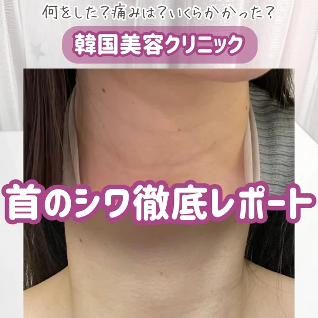 首のシワ治療│体験談を徹底レポ!