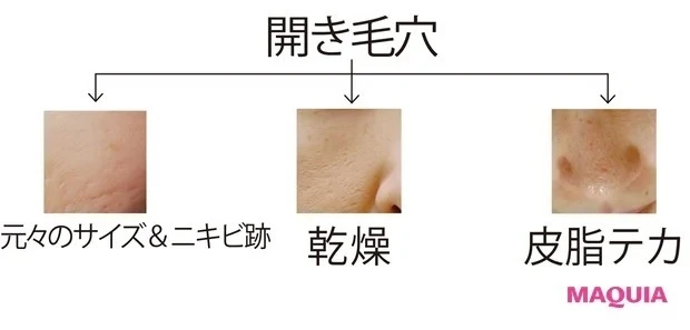 化粧崩れの原因にもなる「開き毛穴」とは?