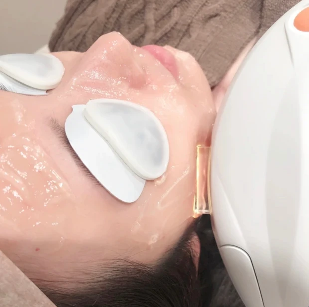 【美容医療】シミ対策に4回目のフォトフェイシャル＊施術内容・効果・痛み・ダウンタイムについてくわしくレポートします！_3