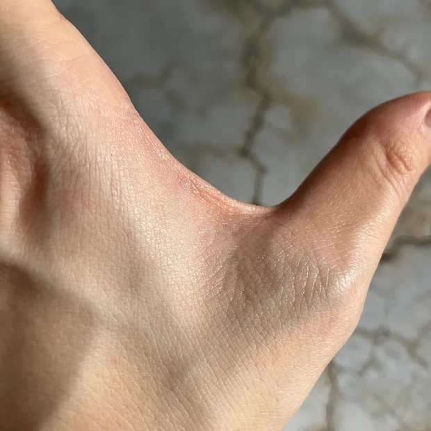 【ディオール】目元&ほうれい線にも！まるで塗る美容医療と言われる、「ヒアルロン酸補充」美容液【カプチュールトータル ヒアルショット】_7