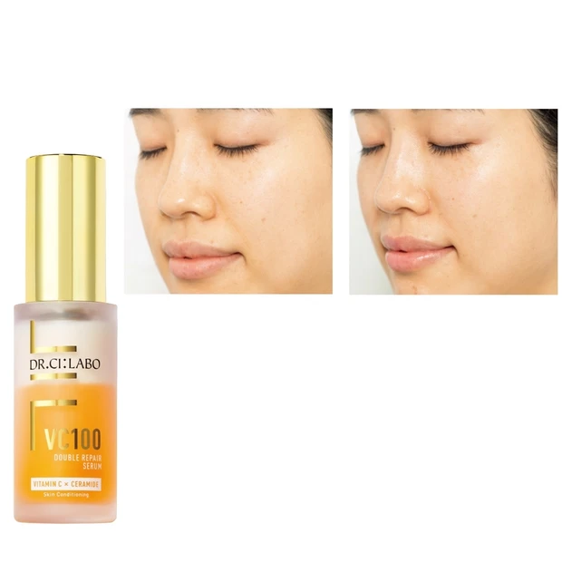 受賞コスメ・ドクターシーラボの美容液でシミステージに変化が!?お試しレポ…