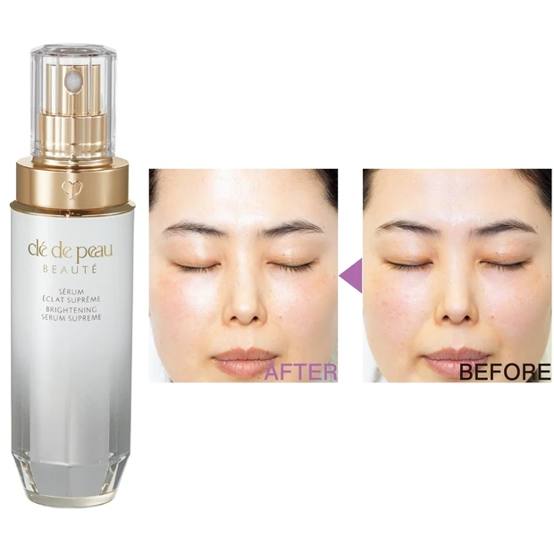 シミ32％改善！ 「クレ・ド・ポー ボーテ セラムエクラS」を試してみた…