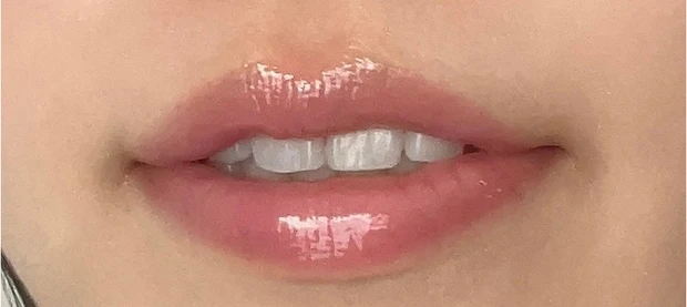 グラスティングカラー グロス 01 ピオニーバレー