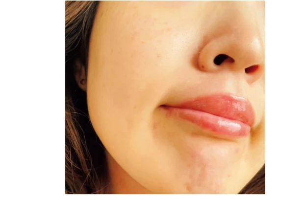 翌朝には実感する即効性に大感激