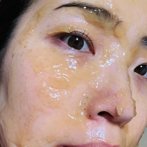 メディプローラーのCO2ジェルマスクの使用イメージ