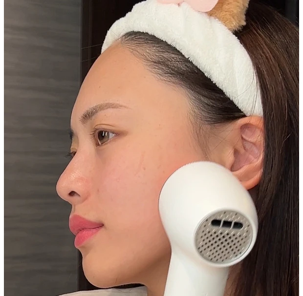 【必見】2024年やってよかった美容♡美容医療・ホームケア・美顔器、効果があったのはコレ！_6_2