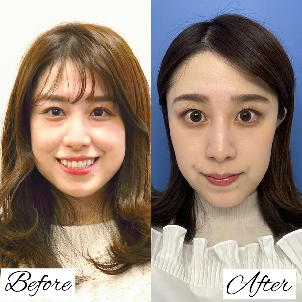 ついにマスク着用緩和!もう"マスク美人"なんて言わせない⁉︎「あれ...マスクとった方が美人」と思わせるぐらいの"素肌美人ケア"をご紹介します。_6