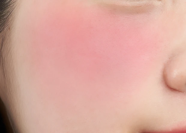 RS05 フィルム チーク