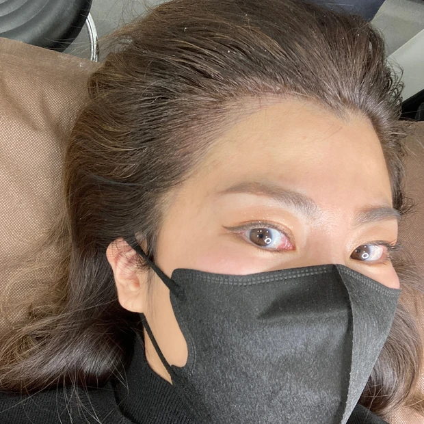 施術動画あり!ヘアラインアートメイクって知ってる?生え際のアートメイクとっても気に入ったのでレビューします!
_5_2