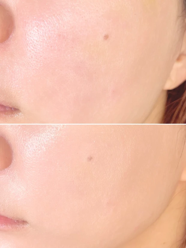 上:すっぴん 下:ファンデーション使用後