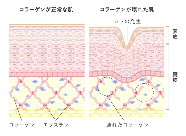 【医師が監修】コラーゲンとは? 美容に役立つ成分の特徴について-美容成分事典-_2
