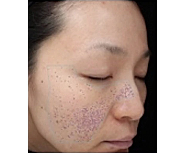 【夏の冷スキンケア】朝・昼・夜におすすめのスキンケアアイテム PhotoGallery_1_4