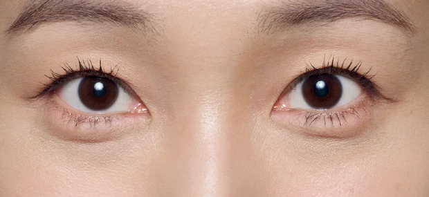 紫ぐま×たるみぐまタイプのくまカバー＆涙袋メイクのテクニック アフター