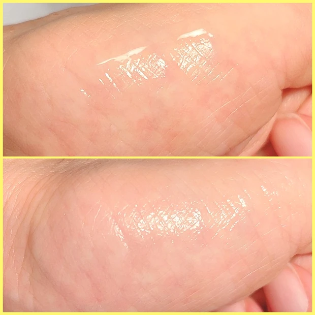 大人ニキビや肌荒れに悩む方に是非使ってほしい「イプサ ザ・タイムアクア R(医薬部外品)」の人気の秘訣について語る_2_3