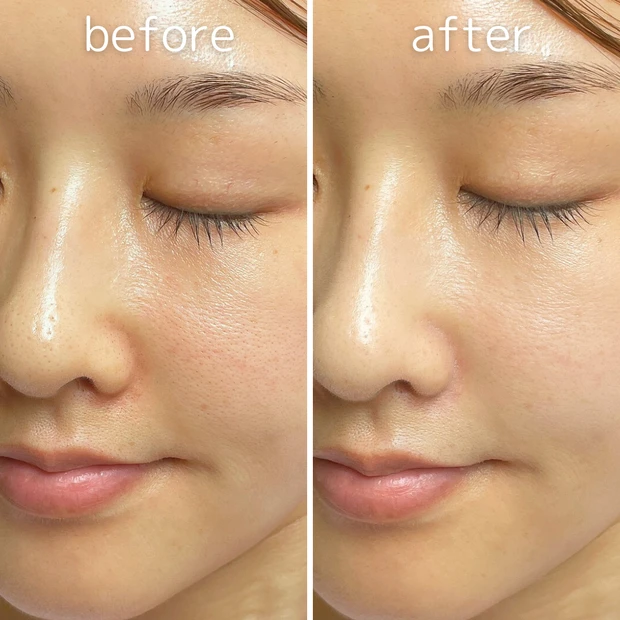 イエベ春ツヤ肌好き３３歳２児のママ！【2024年上半期MYベストコスメ１２選❣️】プチプラ多め❣️ポーラアイクリーム衝撃のビフォアフも公開…！_14_3