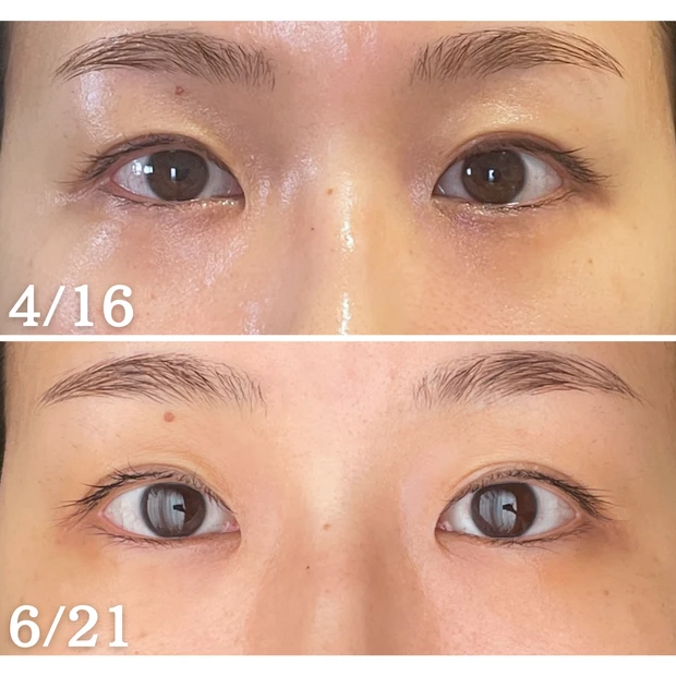 イエベ春ツヤ肌好き３３歳２児のママ！【2024年上半期MYベストコスメ１２選❣️】プチプラ多め❣️ポーラアイクリーム衝撃のビフォアフも公開…！_10_2