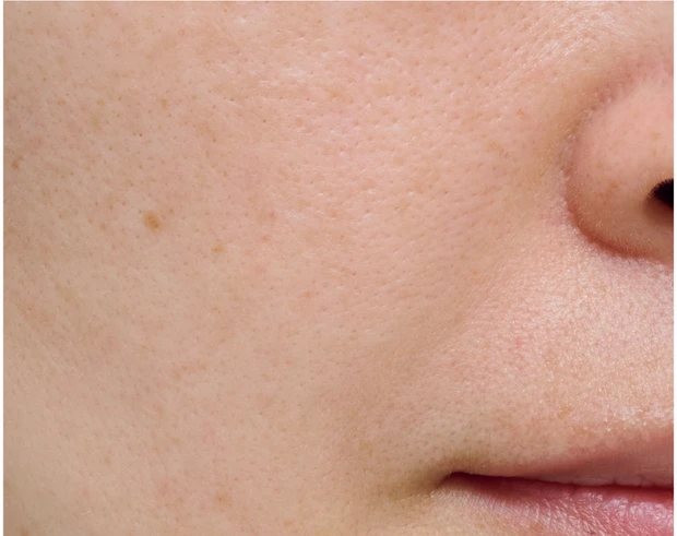 【悩み別】毛穴を目立たなくする方法 PhotoGallery_1_35
