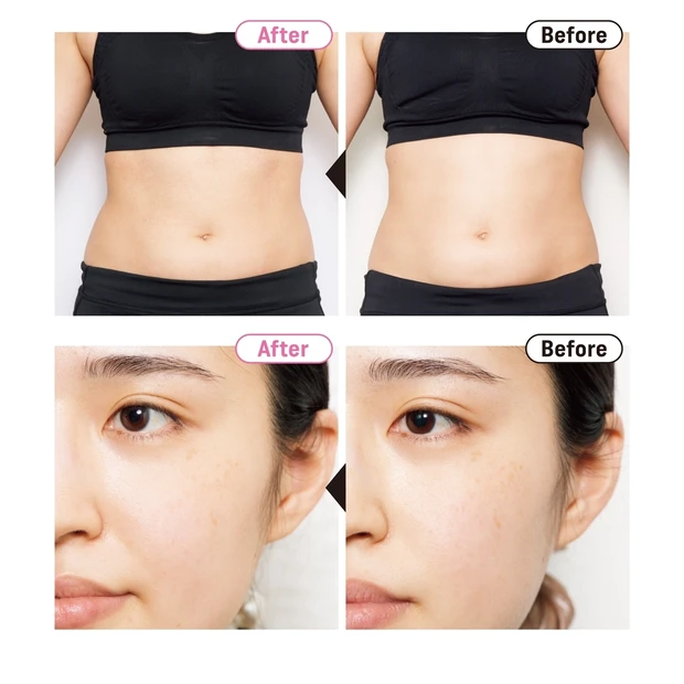 マキアスタッフの劇的ビフォー・アフターは必見! “私に合った美容医療”お…