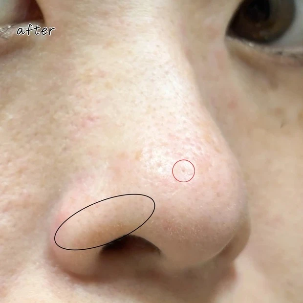 コスメデコルテ AQ 毛穴美容液オイルの口コミ 乾燥肌