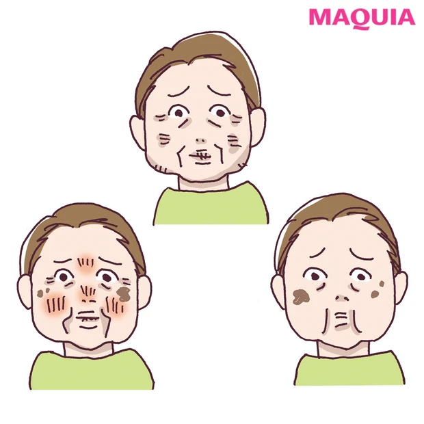 乾燥タイプをチェックリストで診断! あなたに足りないのは水? 油?