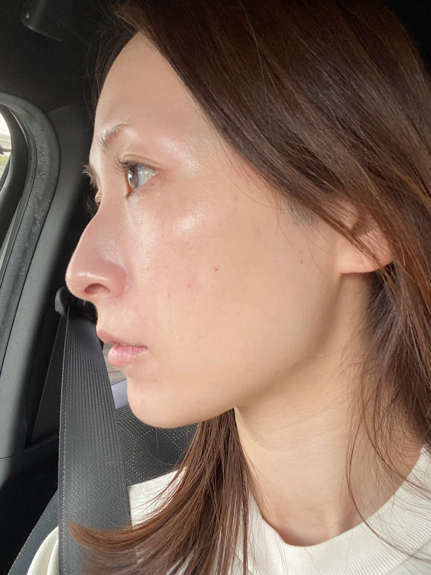 DT中のノーファンデ肌におすすめの愛用アイテム3選!無加工画像でリアルにお届けします!_4