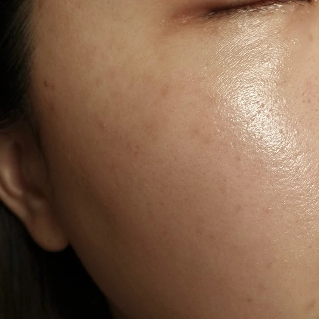 【ご当地美容】上海のヨセミテクリニックでM22(IPL治療)を受けてみた！6回コースでシミそばかすに効果あり！_8_2