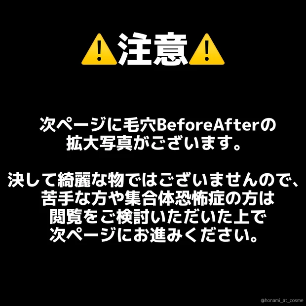 【毛穴汚れに悩む女性必見】どろっと流れる角栓!毛穴レス美人になりたいならコレッ!👃✨【閲覧注意】_5