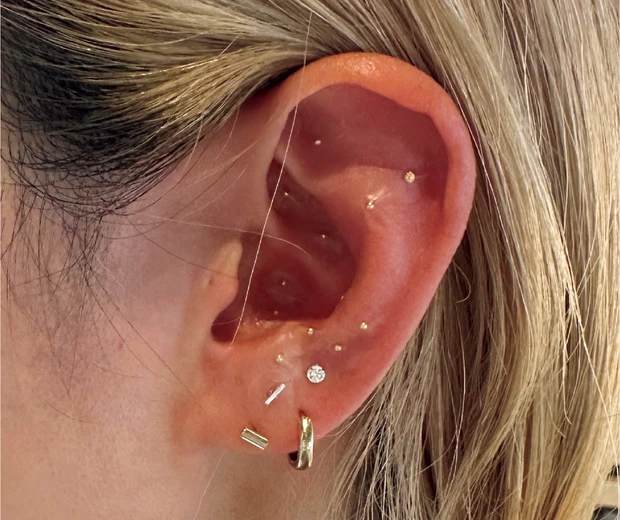 岡田知子さん 耳つぼ