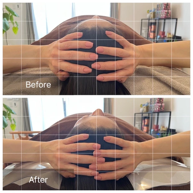 【7年目も内面美容を極めたい】アトピー肌×ハーフ顔bekiが目指すはストイックビューティー_3