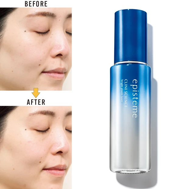 エピステーム　ブライトプラズムレーザー