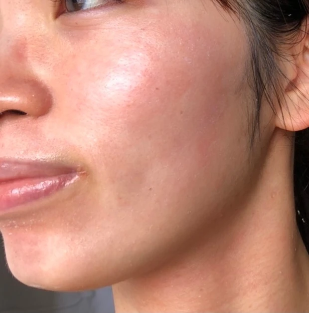 【ゼオスキンヘルス】剥け剥け生活3ヶ月終了しました！~体験報告~_5_2