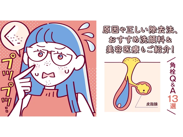 【角栓Q&A13選】原因や正しい除去法、おすすめ洗顔料＆美容医療もご紹介！〈皮膚科医監修〉