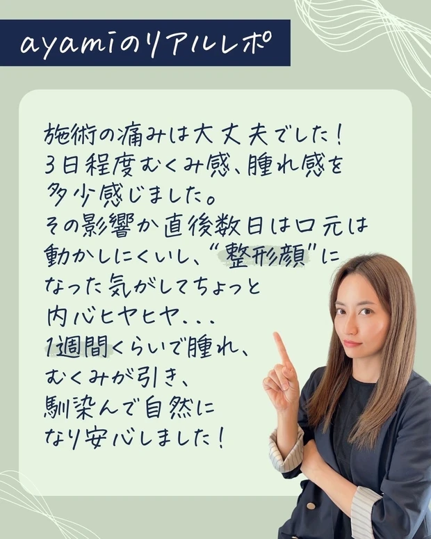 ヒアルロン酸注入は整形顔になる？はじめてのヒアルロン酸をレポート！_4_2
