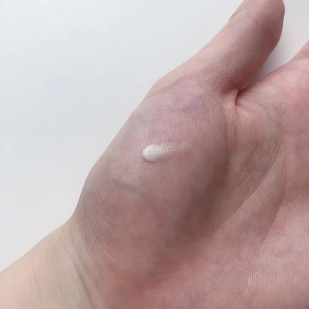 【絶対跡残さない！】肌荒れ対策、ニキビ跡ケア5選_1_2