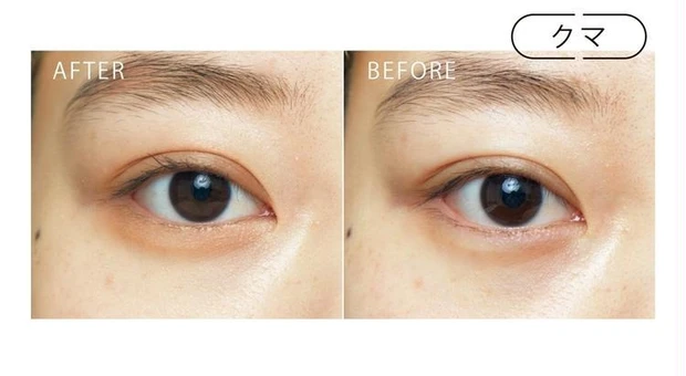 クマ BEFORE/AFTER