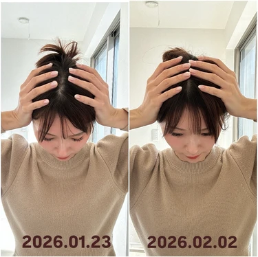 フェイスポインター待望の新作「 ホライゾン」が凄い！“頭コリ”にアプローチ。私の10日間の変化＜BA写真あり＞_3_6