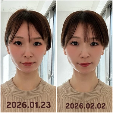 フェイスポインター待望の新作「 ホライゾン」が凄い！“頭コリ”にアプローチ。私の10日間の変化＜BA写真あり＞_3_5