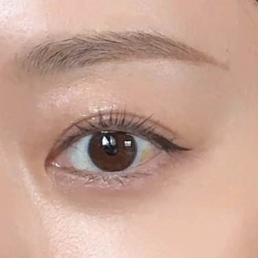 ①小鼻〜目尻