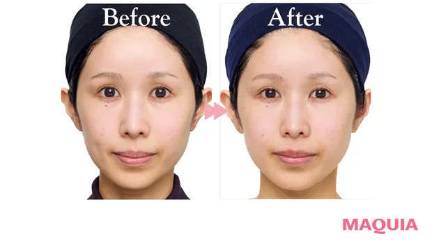 2026年最新作 おすすめブライトニングスキンケアコスメ TAKAMI タカミブライト スポットB3＋ 肌の明るさの変化