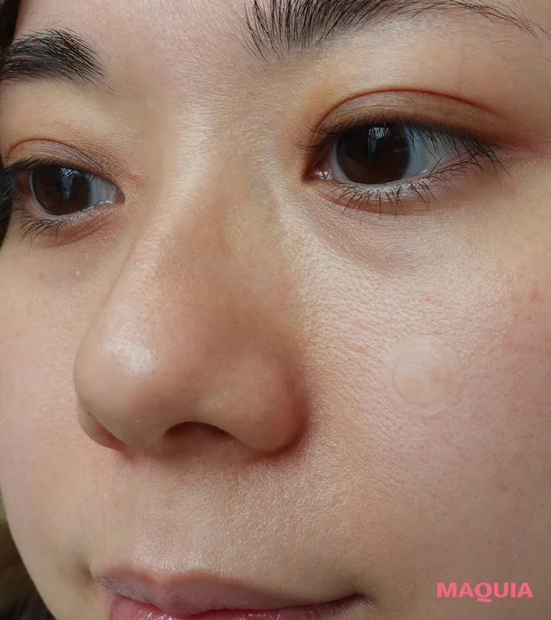 ゼロスポットパッチ