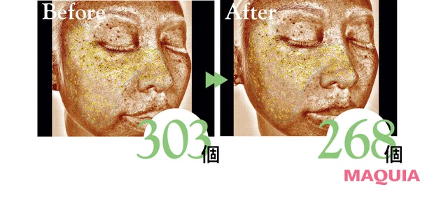 クレ・ド・ポー ボーテ セラムエクラS Ⅱ 使用前後の表面下シミの個数