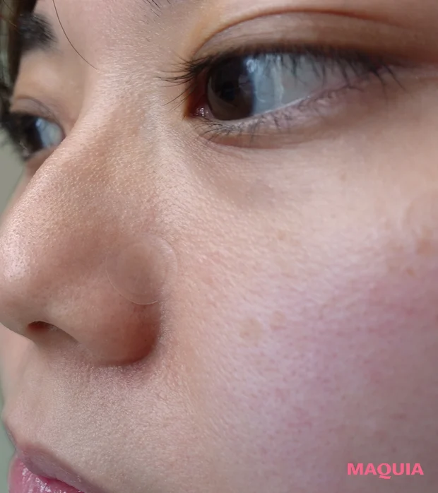 VT プロシカクリアスポットパッチ　レビュー