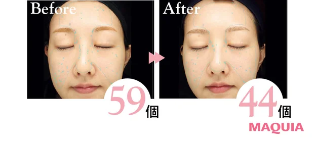 2026年最新作おすすめブライトニングコスメ エクシア シリウス スターブライト セラム 表面シミの個数変化