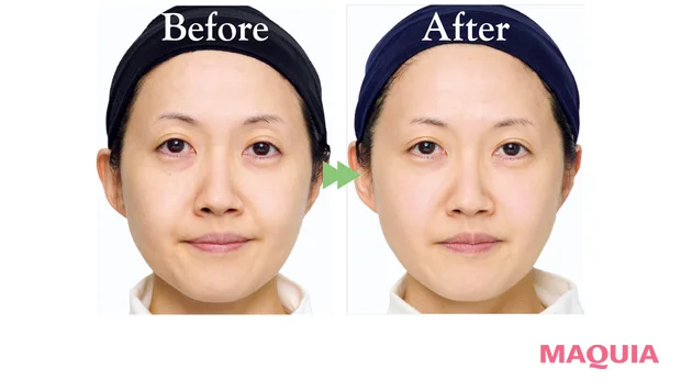 2026年最新作おすすめのブライトニング美容液 30日間使用ビフォーアフター ONE BY KOSÉ メラノショット P