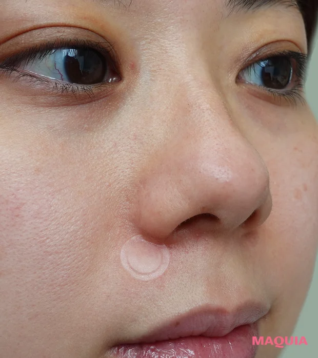 ゼロスポットパッチ CICA　レビュー