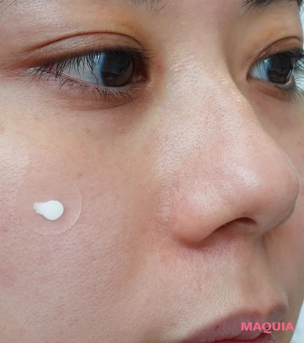 薬用 スポッツクリーム [ニキビ集中ケア] 専用パッチ付 アクネスラボ　レビュー