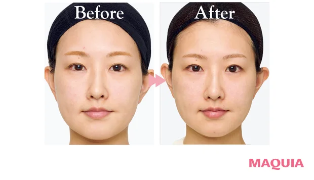 2026年最新作おすすめブライトニングコスメ エクシア シリウス スターブライト セラム 肌の明るさの変化