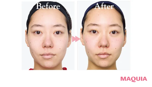 2026年新作スキンケアコスメ Obagi オバジC25セラム NEO 肌の明るさビフォーアフター